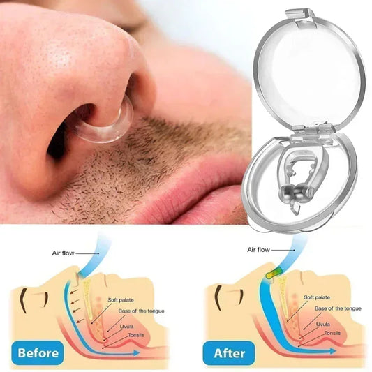 Anti-Snoring Nose Clip Device