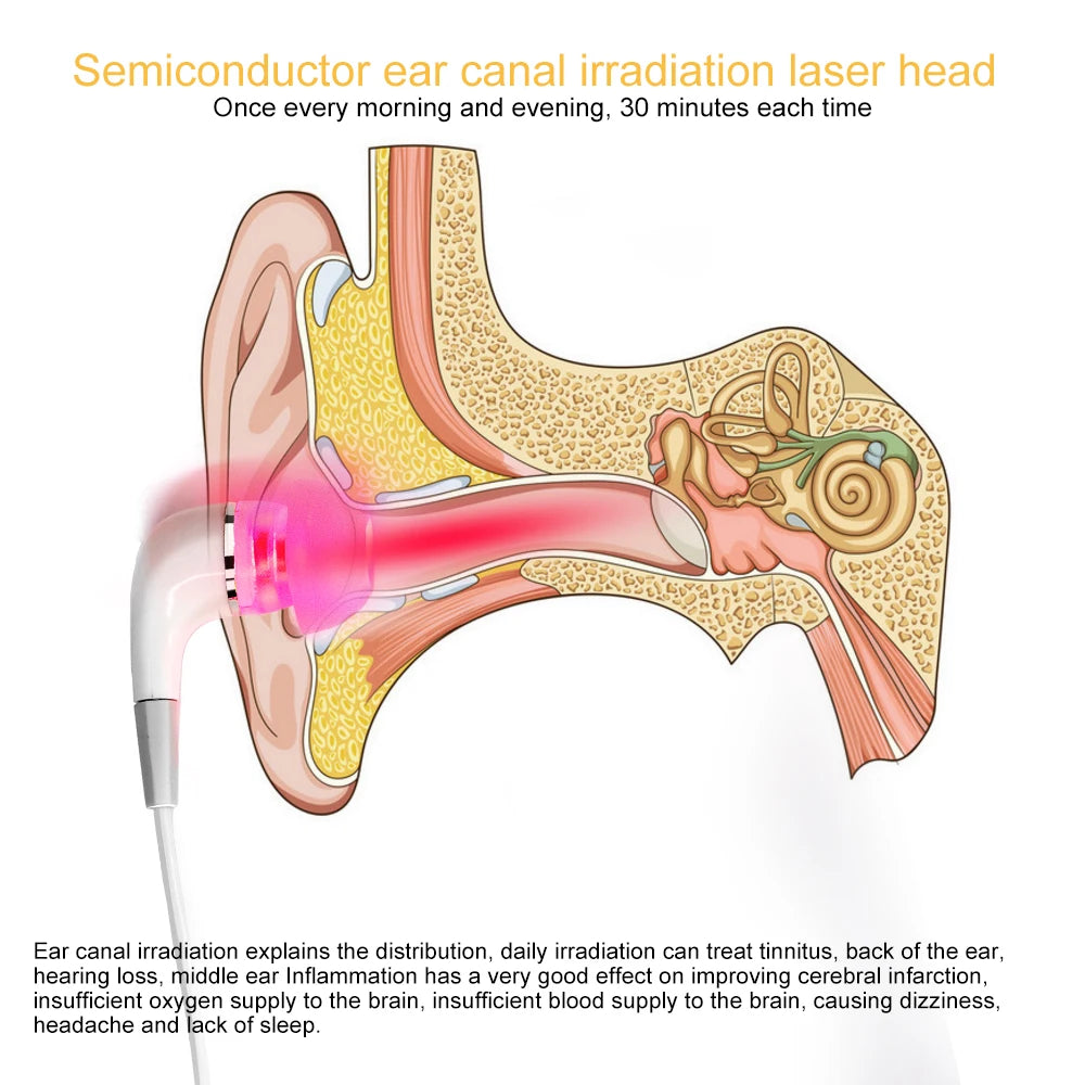 Tinnitus Ear Laser Therapy LLLT Irradiation Laser Physiotherapy Earplug Otitis Media Deafness Diabetes Hypertension Treatment