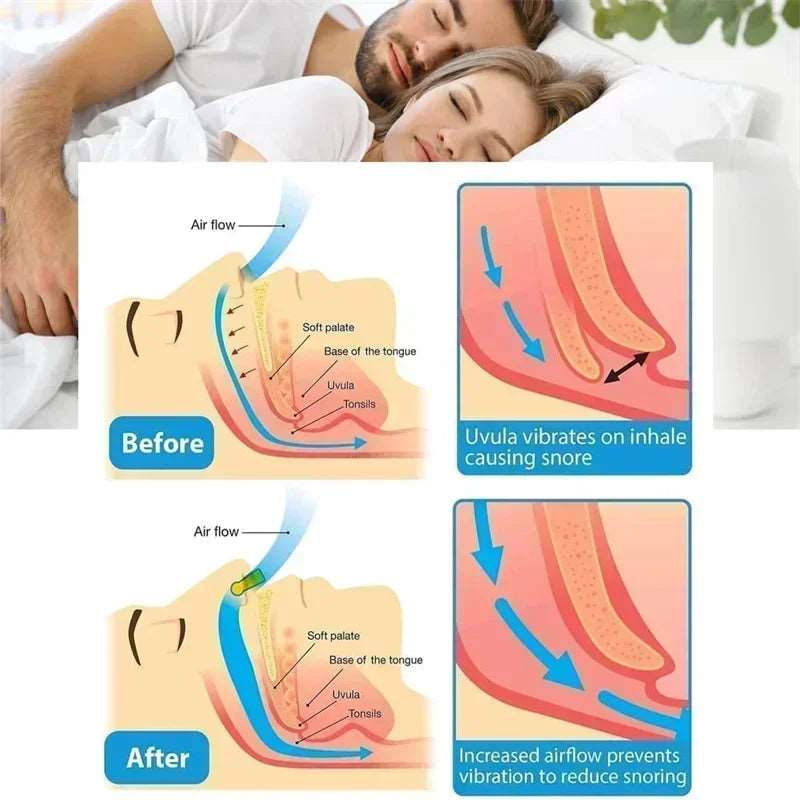 Anti-Snoring Nose Clip Device